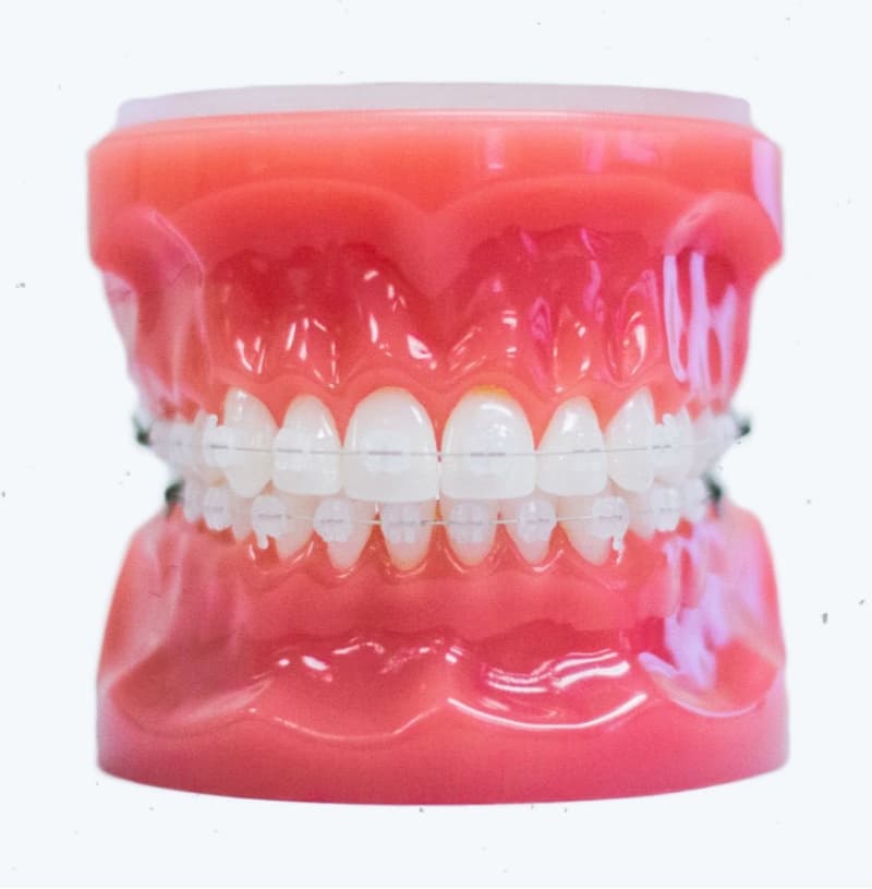 clear ceramic braces on plastic model