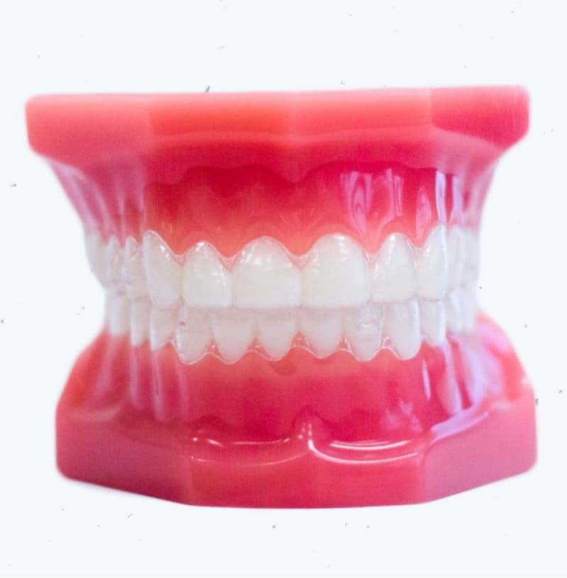 invisalign aligners on plastic model